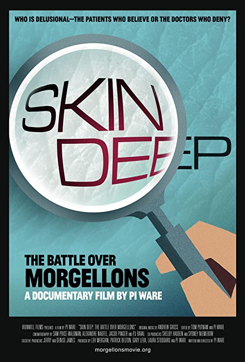 دانلود مستند Skin Deep: The Battle Over Morgellons 2019 - پوست عمیق: نبرد بر سر مورگولون ها