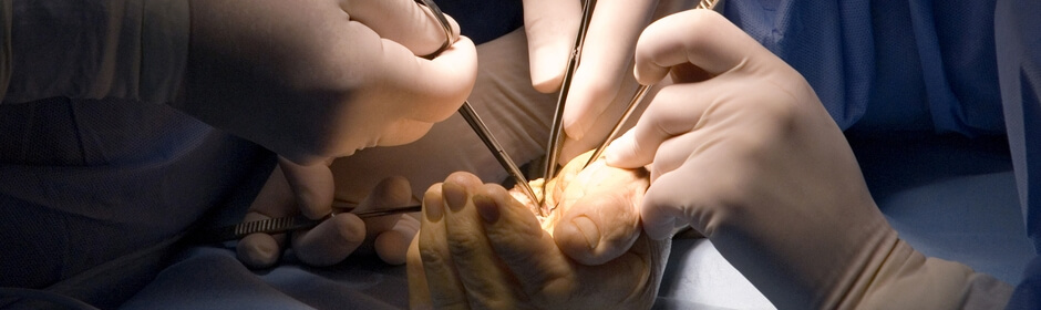 انواع فوق تخصص جراحی دست